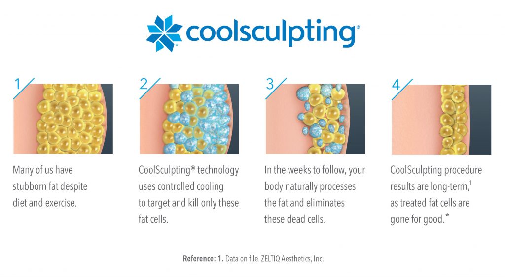 Cool Sculpting Process